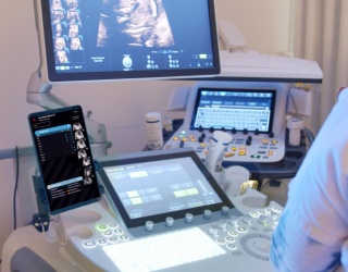 BrightHeart AI Platform Now Available via GE HealthCare Voluson Solution Store