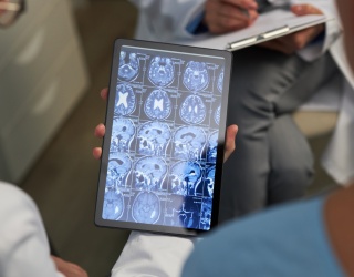 AI Tool Generates Radiotherapy Plans for Cervical and Prostate Cancer in Multinational Study