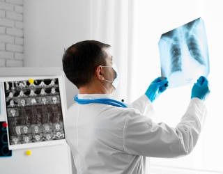 Photo: Lung Cancer Screening: Implementation Determines Impact...
