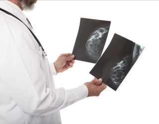 Photo: MBI in Dense Breasts: Stronger Evidence for Supplemental Screening...