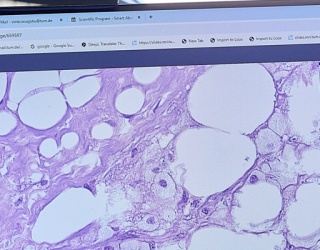The Brand New World of Fully Digitized Pathology