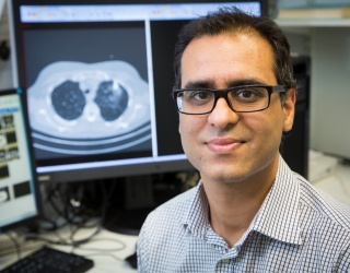 Photo: Transforming Lung Cancer Screening with AI