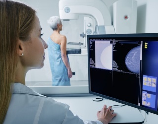 RadNet and iCAD Unite to Revolutionize AI-Driven Breast Cancer Detection