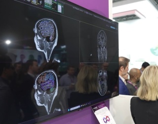 Photo: DeepHealth drives screening efficiency, impact...