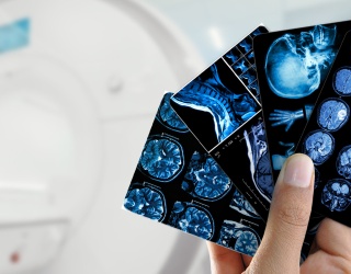 Photo: Positive results from Phase III study for Bayer’s investigational...