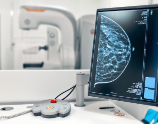 Photo: ScreenPoint Medical Acquires Biomediq A/S to Expand Breast Cancer Risk...