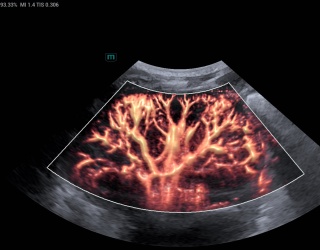 A new era for ultrasound’: European healthcare professionals react to new ultrasound technology