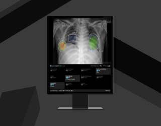 Lunit INSIGHT CXR4 Gains CE-MDR Certification, Expands AI Capabilities for Chest Imaging