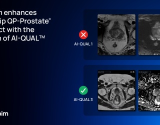 AI-QUAL: First AI Module for Automated Prostate MRI Quality Scoring