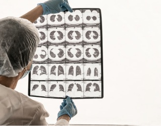 Photo: Post-COVID CT Guidelines by International Radiology Consensus...
