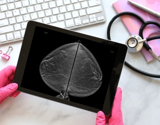 Photo: Gnosis for Her Launches Mobile 3D Breast CT Care Unit...