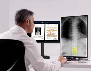 Photo: Medimaps Introduces TBS Reveal for AI X-Ray Bone Screening...
