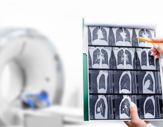 Photo: RSNA 2025: From AI Promise to Workflow Accountability...