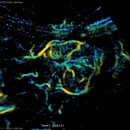 an ultrasound image