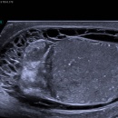 an ultrasound image