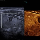 an ultrasound image