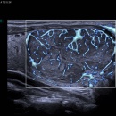 an ultrasound image
