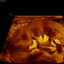 an ultrasound image