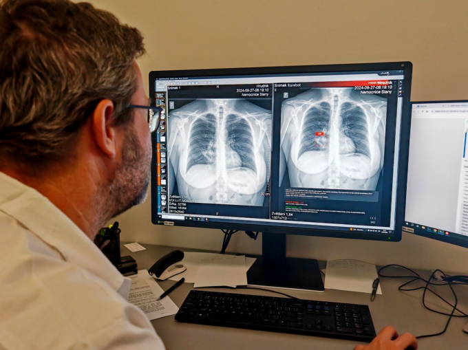 A man looks at an x-ray image on the computer