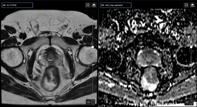 MRI image