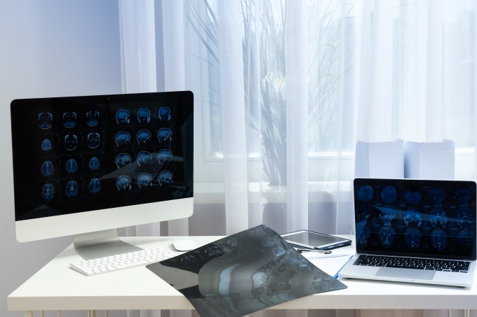 Brain scans displayed on a monitor, laptop, and film sheet on a desk....