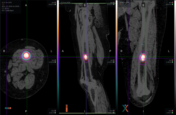 An x-ray image