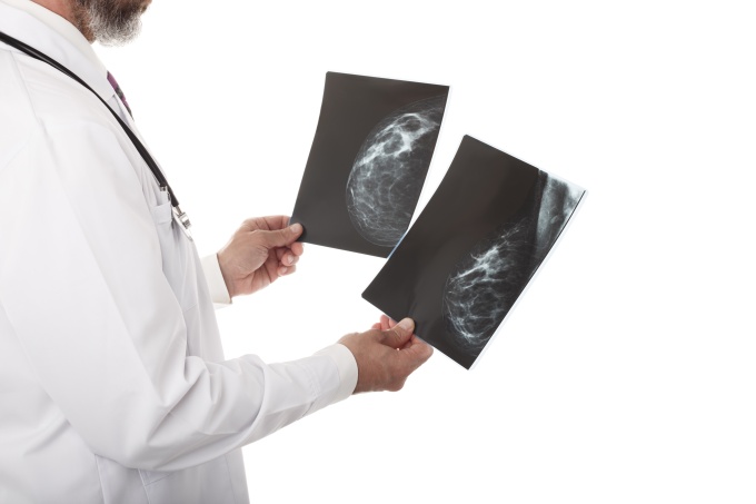 Person holding breast scans