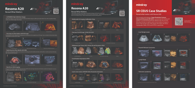 A graphic from Mindray showing various ultrasound images...