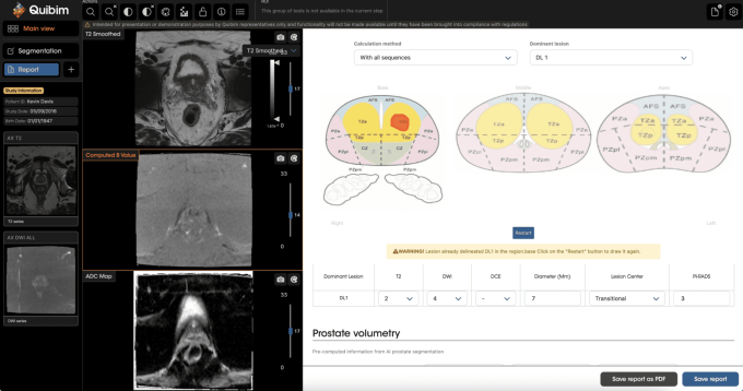 A picture where you can see the results of a scan
